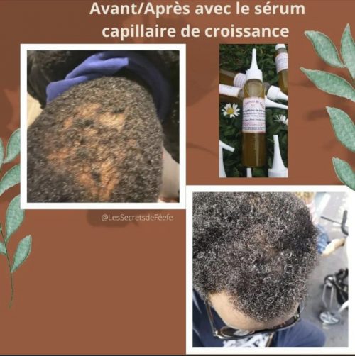 Sérum capilaire de croissance – Image 5